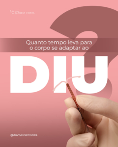 Quanto tempo leva para o corpo se adaptar ao DIU?